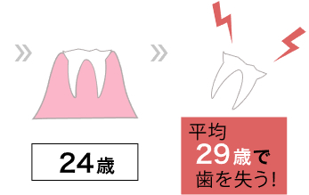 銀歯や金歯、プラスチックのデメリット