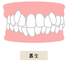 叢生