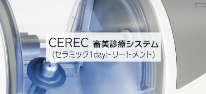 セレック治療Cerec CAD/CAM System